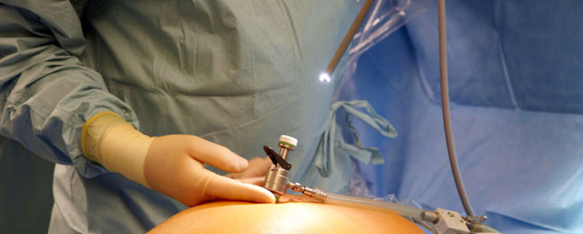 Kapalı ameliyat yöntemleri uygun hastalarda çok başarılı ve konforlu şekilde uygulanmaktadır...