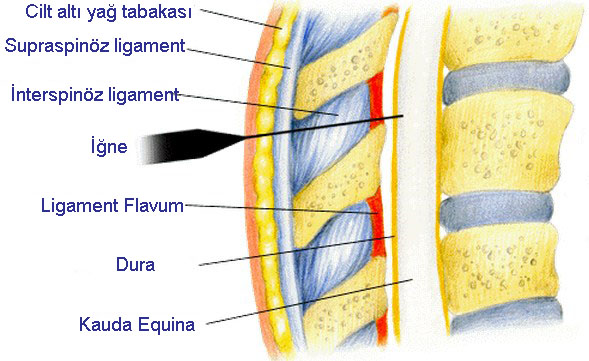 spinal