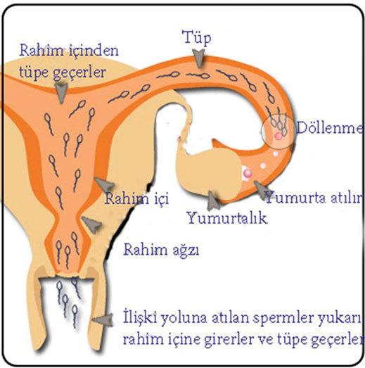 Rahim tüp Sperm geçişi